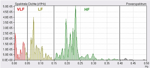 Ergebnis einer Spektralanalyse